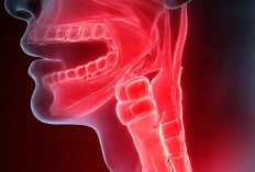 Apa Itu Throat Irritation? 