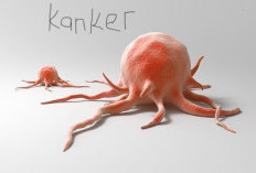 9 Penyebab Timbulnya Kanker 