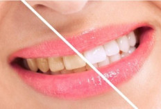 Miliki Gigi Putih Bersinar dan Sehat Dengan Bahan Alami ini, Apa Saja? Yuk, Simak Informasinya