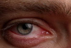 10 Tanda Mata Lelah atau Eye Strain