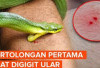 Pertolongan Pertama Saat Digigit Ular Berbisa